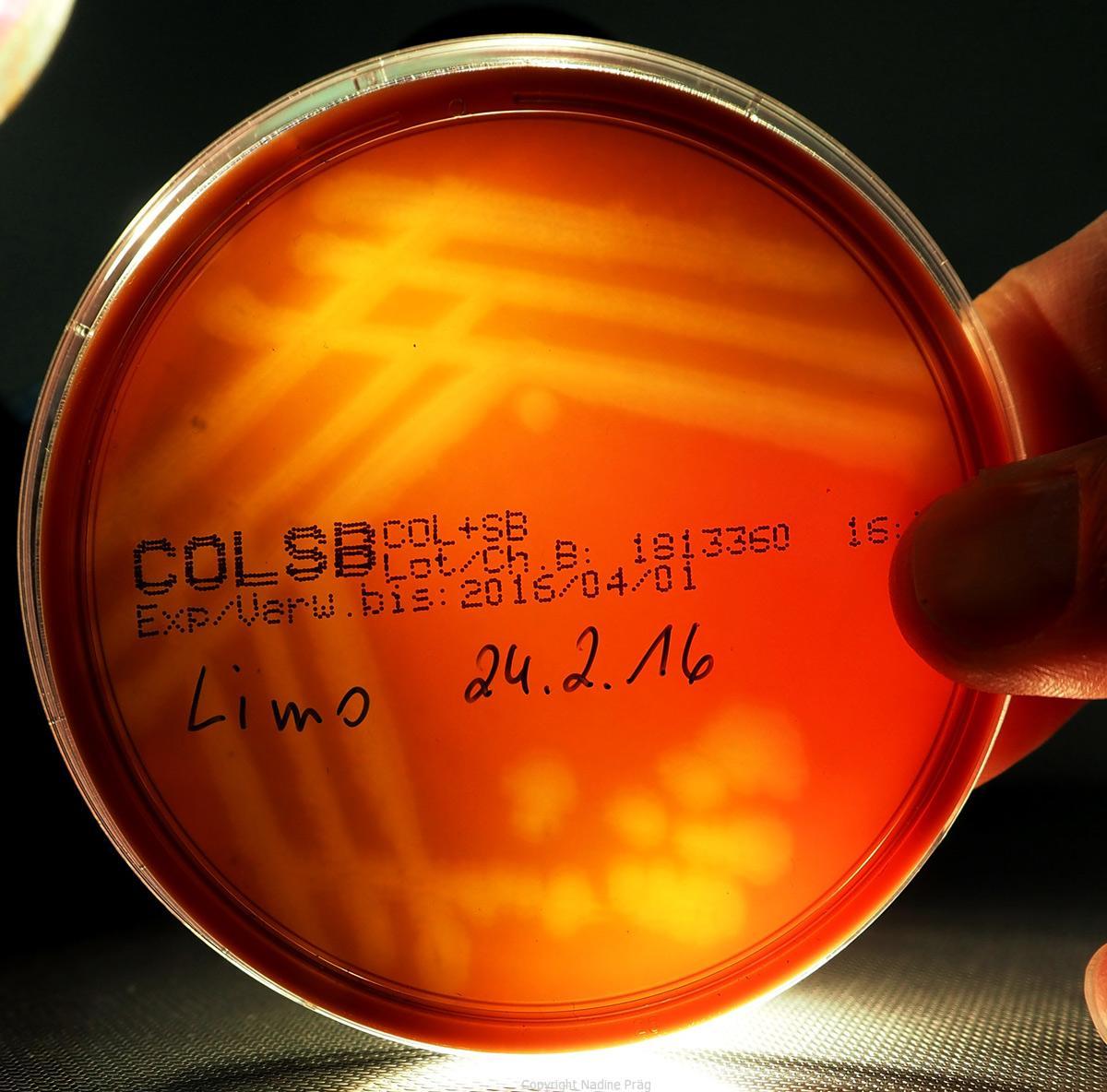 Lebensmittel Mikrobiologie I mikrobalpina